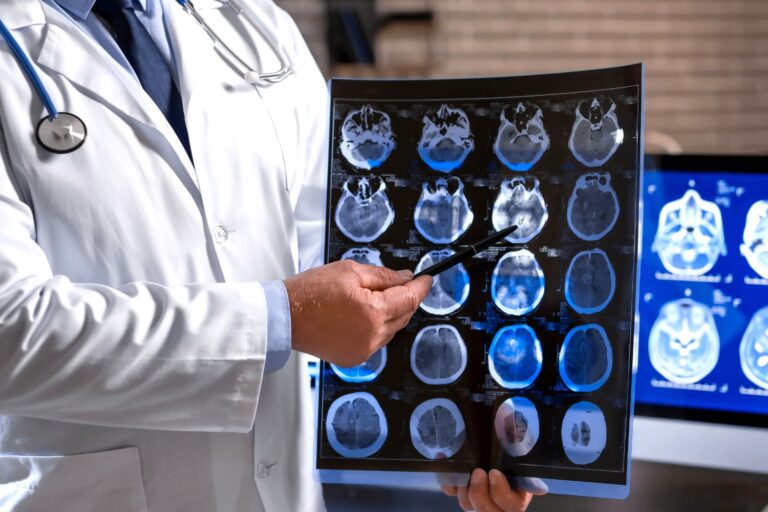 Questions to Ask a Neurologist